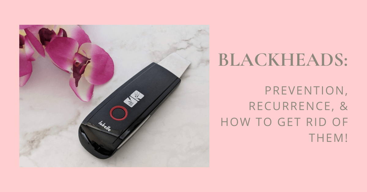 Blackheads: Prevention, Recurrence, & How to Get Rid of Them!