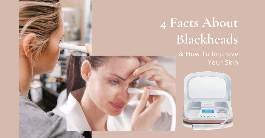 4 Facts About Blackheads & How To Improve Your Skin