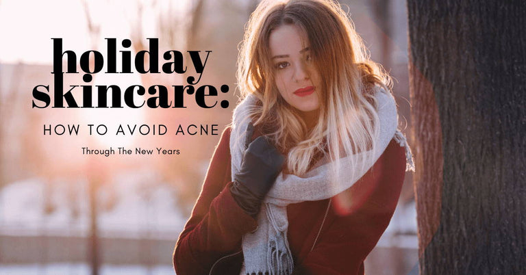 avoid acne on holidays and though new year