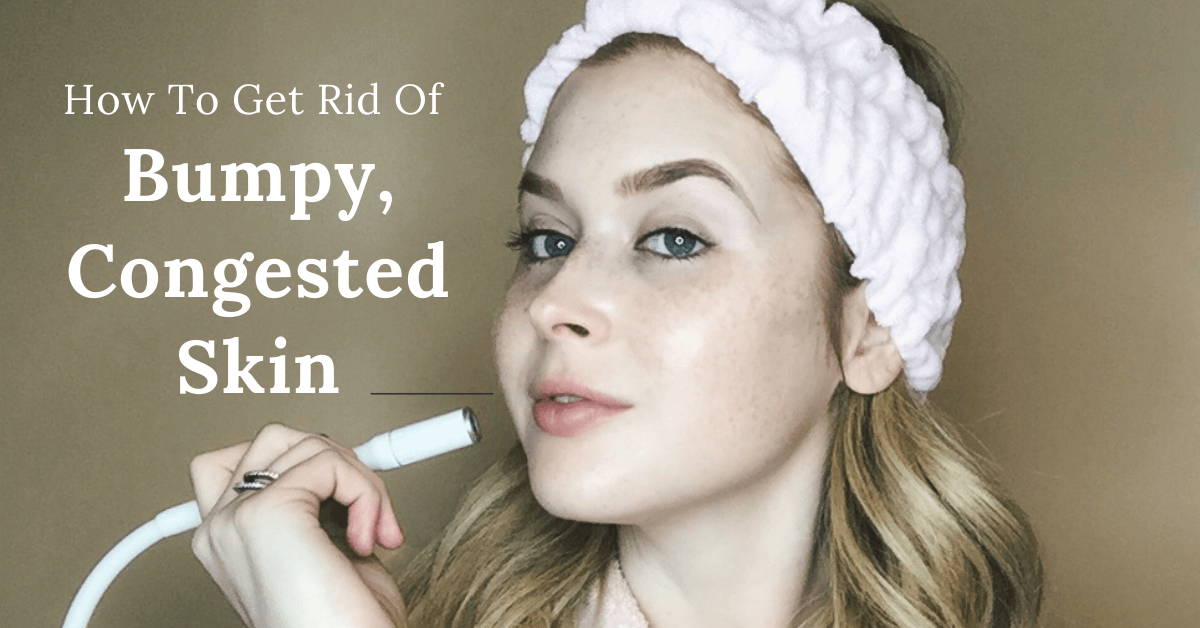 get rid of bumpy congested skin prone to breakouts